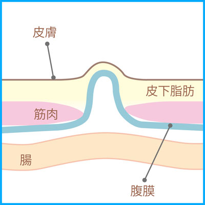 病態